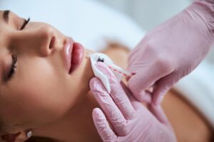 lip fillers birmingham uk